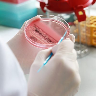 Szpital MSWiA w Poznaniu Pracownia Bakteriologii