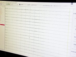 Zdjęcie przedstawia wykres czynności elektrycznej mózgu człowieka na monitorze komputerowym