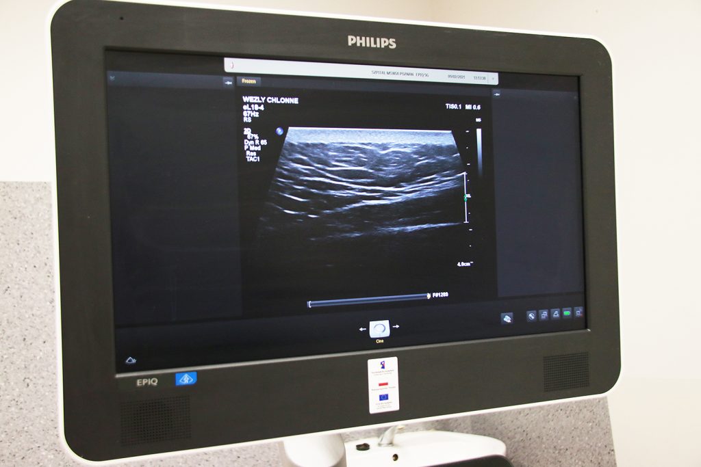 Zdjęcie przedstawia monitor a na nim widoczne obraz badania USG