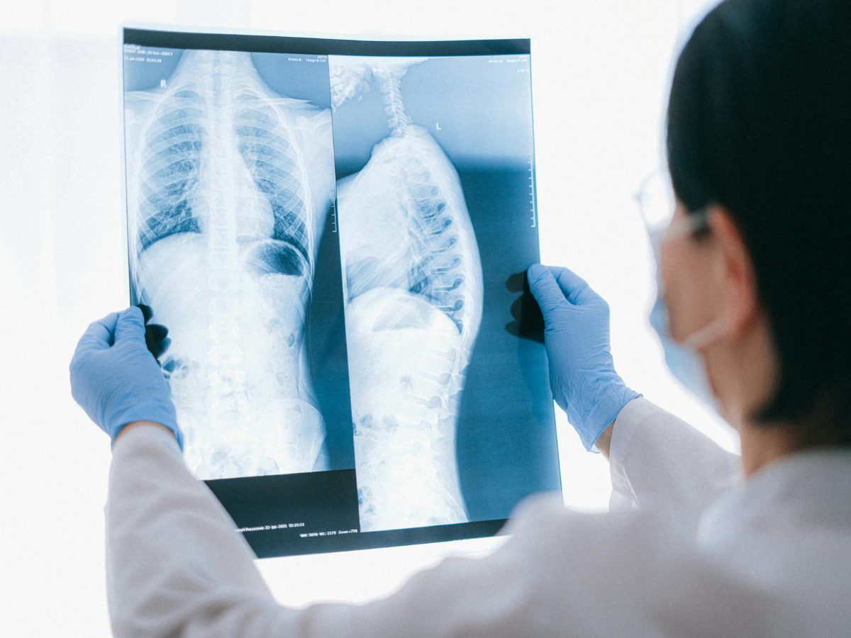 Era radiologii wspomaganej AI