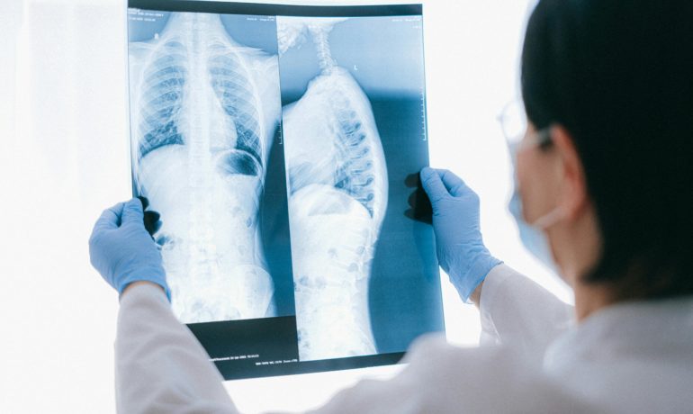 Era radiologii wspomaganej AI