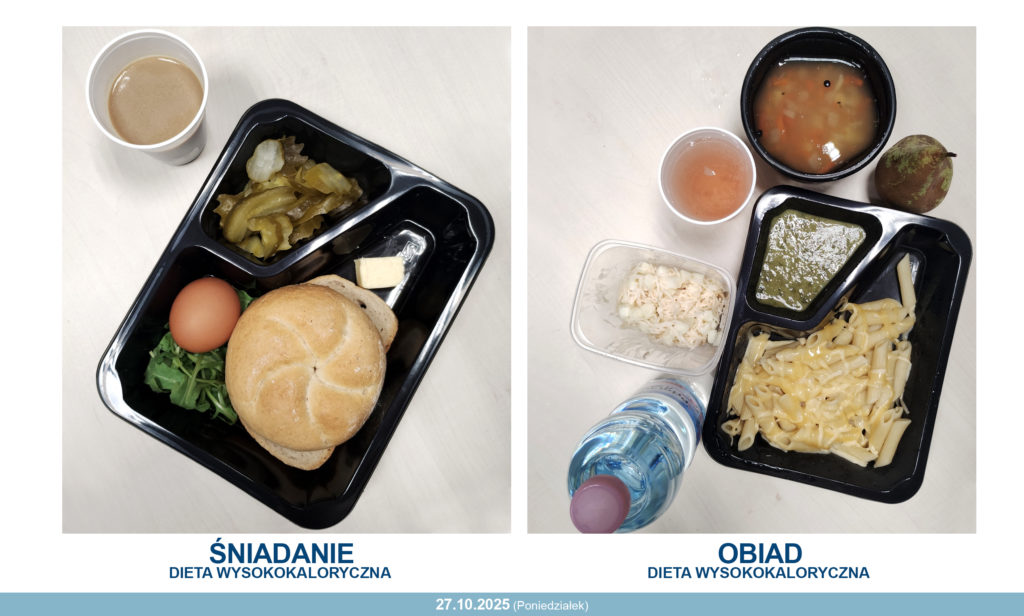 dieta wysokokaloryczna